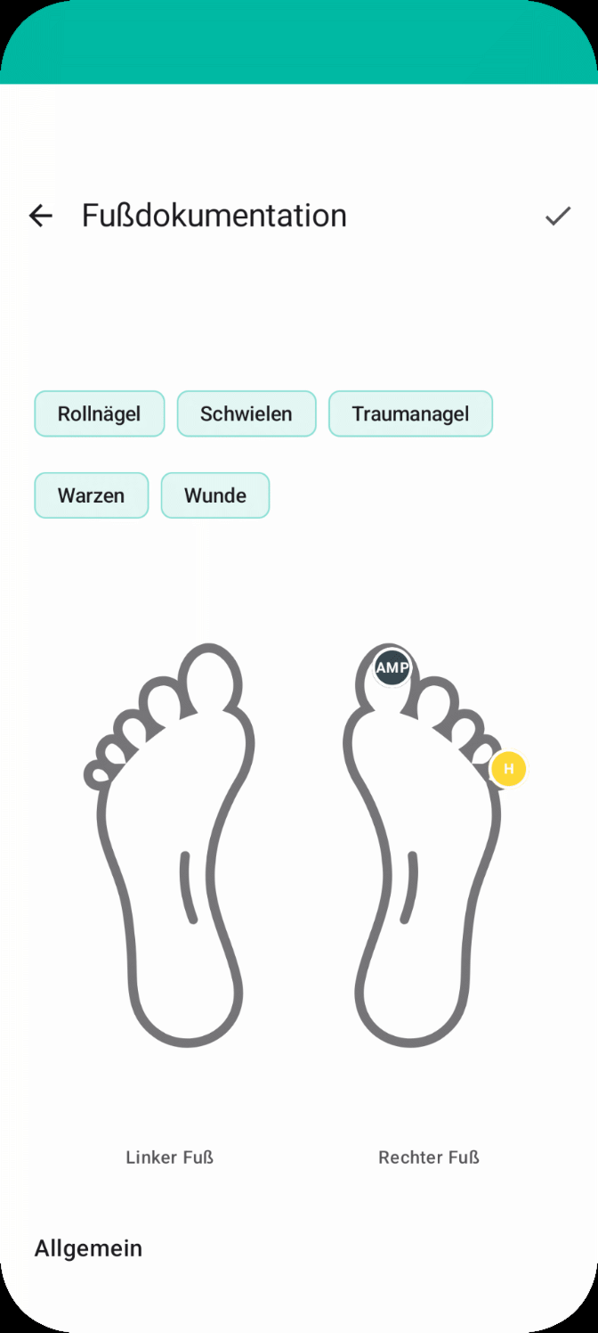 Fußpflege Dokumentation in Podologix: Punktarten wie Hornhaut, Hühneraugen und Traumanagel als farbige Punkte auf einer Fußsilhouette, linker und rechter Fuß getrennt
